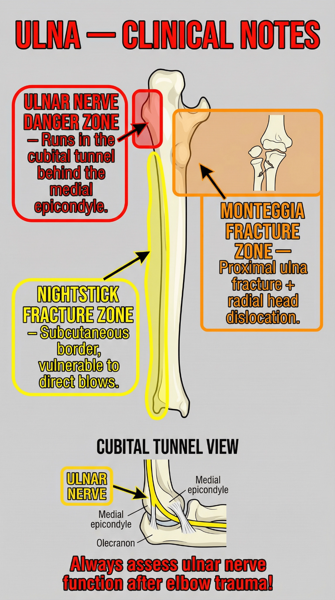 Ulna clinical notes: ulnar nerve danger zone, nightstick fracture zone, and Monteggia fracture zone